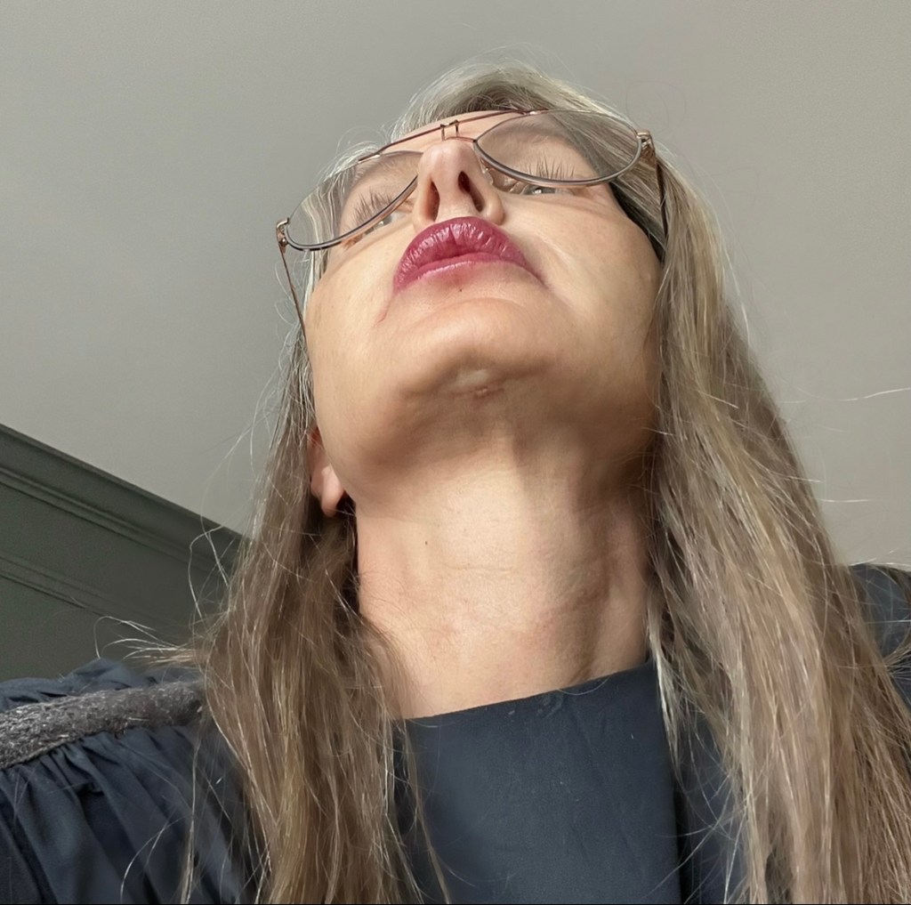 6 weeks post&nbsp;op